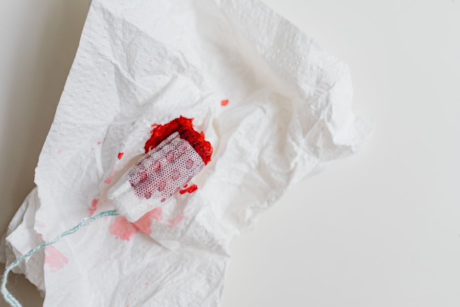 When Is Rectal Bleeding Hemorrhoids or a Fissure—and When Is It Serious?